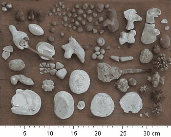  Clculos renais de diversos tipos e tamanhos (Fonte: Pedra no Rim) 